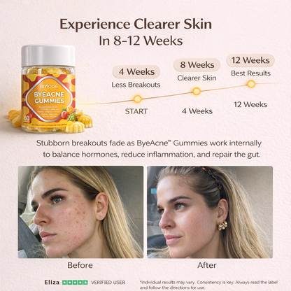 Bye Acne Gummies Subscribe & save